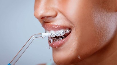 Is water flossing effective?