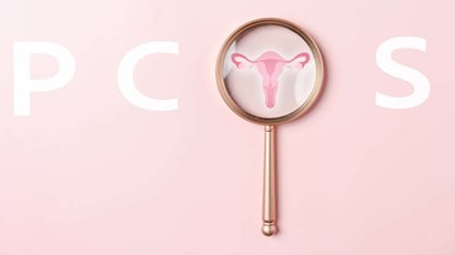 8 common myths about PCOS (Polycystic Ovary Syndrome) 