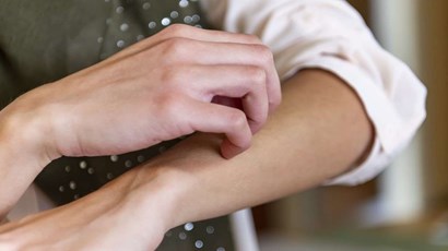 What causes sudden eczema in adults?