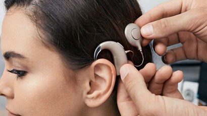 What is a cochlear implant and what effect do they have on hearing?