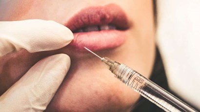 Botox and lip fillers banned for under-18s